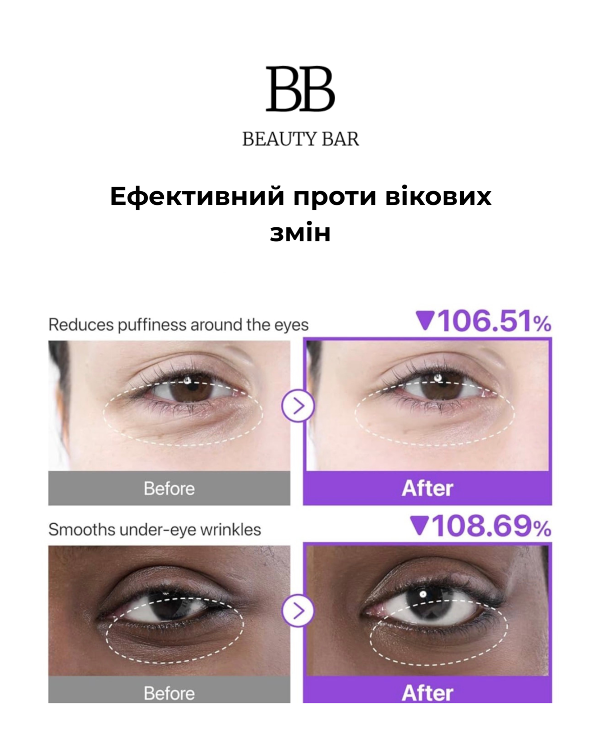numbuzin-no-9-nad-collagen-under-eye-patches-lifting numbuzin-patchi-pid-ochi-z-nad-ta-kolahenom-info