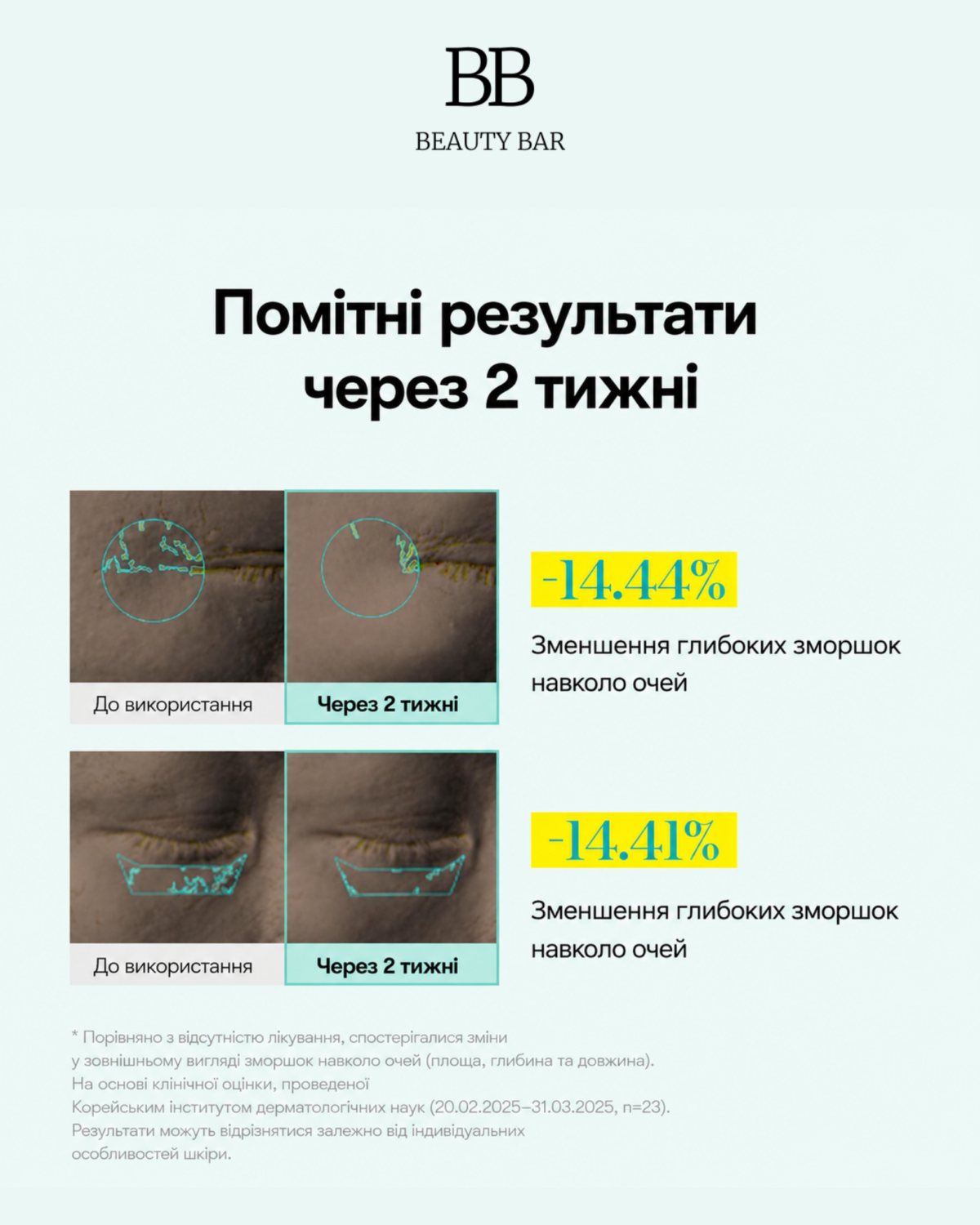 vt-pdrn-reedle-shot-eye-lifter-liftynh-krem-z-aplikatorom-info