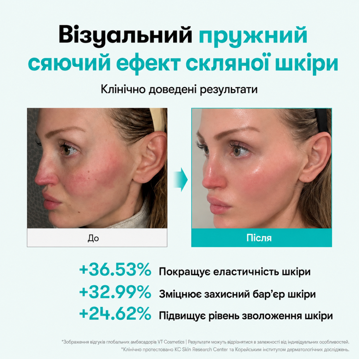 Результат використання VT PDRN Essence 100 інтенсивна есенція з PDRN